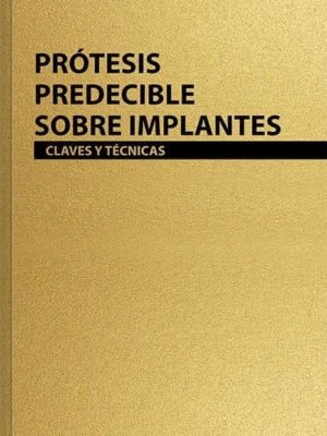 Prótesis predecible sobre implantes